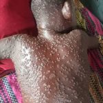 Un nouveau type de moustiquaire a "empêché" 13 millions de cas de paludisme en Afrique