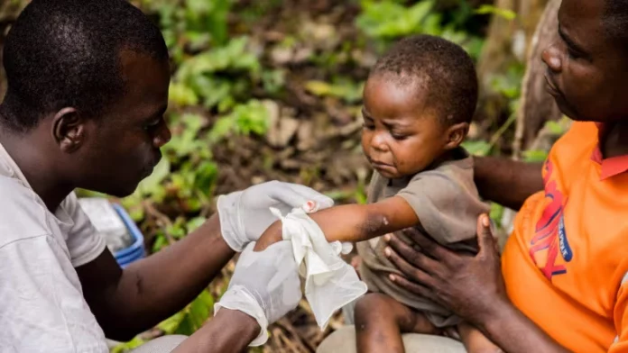 Mpox: une nouvelle souche plus dangereuse et plus contagieuse