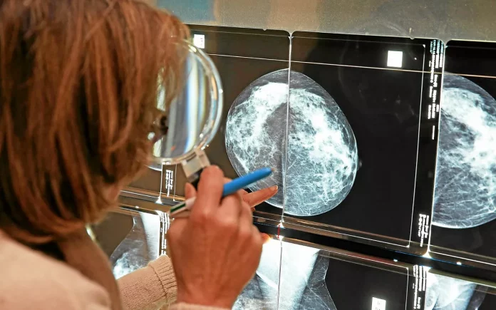 Cancer: des vaccins thérapeutiques, entre espoir et défi