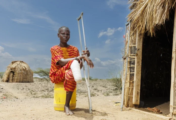 Au nord du Kenya, le dramatique impact du mycétome, et son cortège d’amputations