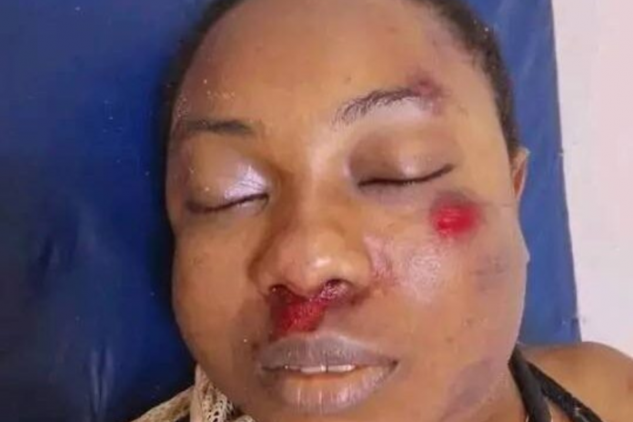 Ndopassi : Une femme meurt percutée par un camion