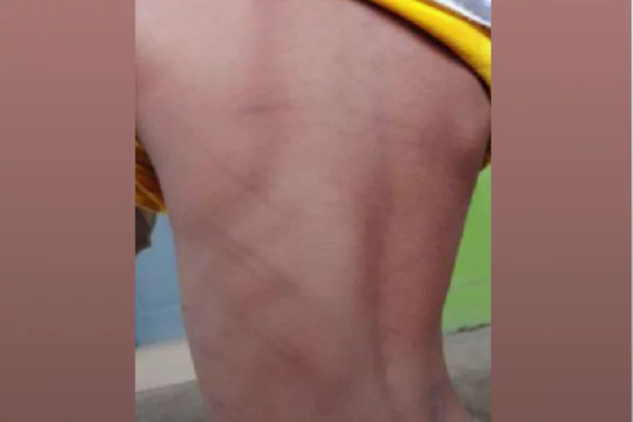 Ndogpassi : Un père accusé de tortures sur son fils de 6 ans