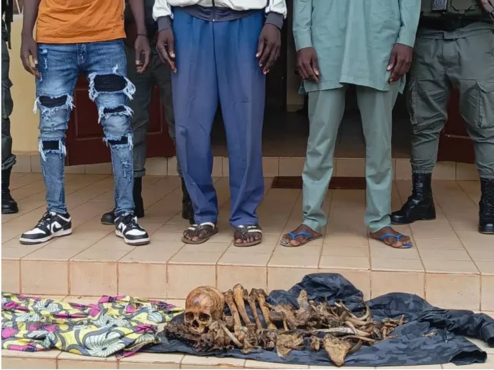 Région de l’Est : Trois jeunes arrêtés avec un squelette humain