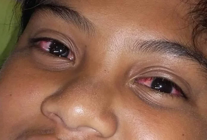 Climat : La saison sèche de tous les maux