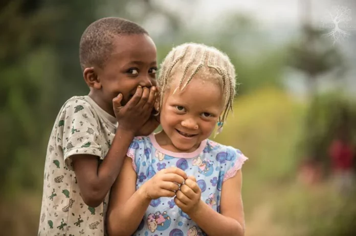 L’albinisme : Une maladie héréditaire ou mystique ?