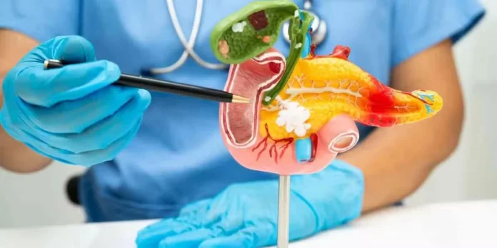 Survie au cancer du pancréas : deux molécules prometteuses ouvrent une nouvelle ère thérapeutique