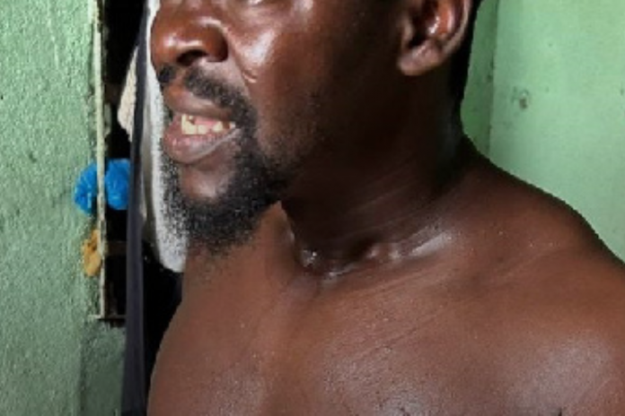 Douala : Habitué à montrer son sexe aux enfants, il se fait lyncher