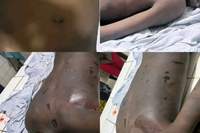 Pouma : Un enfant meurt après une bastonnade pour 500F