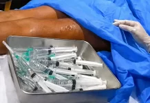 Cameroun : l’inquiétude autour des injections du « body filler » Injections body filler