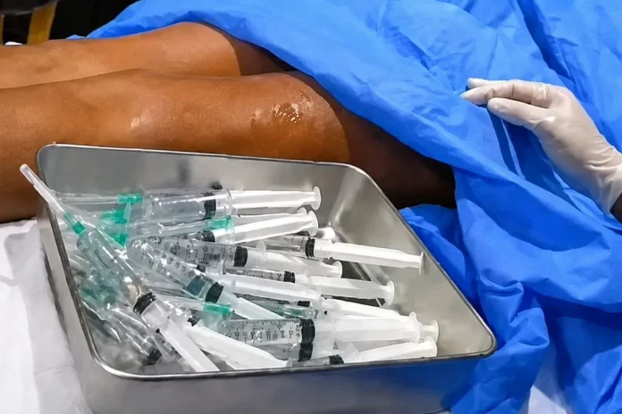 Cameroun : l’inquiétude autour des injections du « body filler »