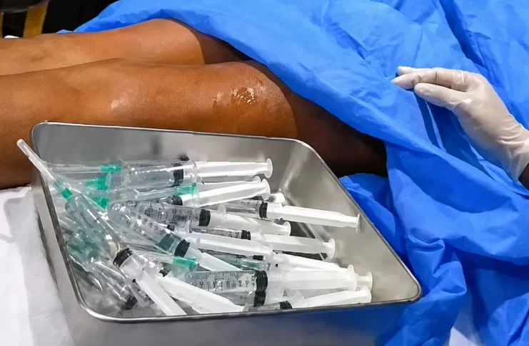 Injections body filler